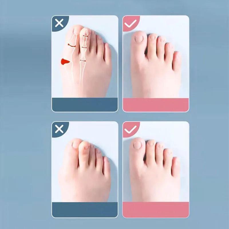 Silicone Toe Spacers