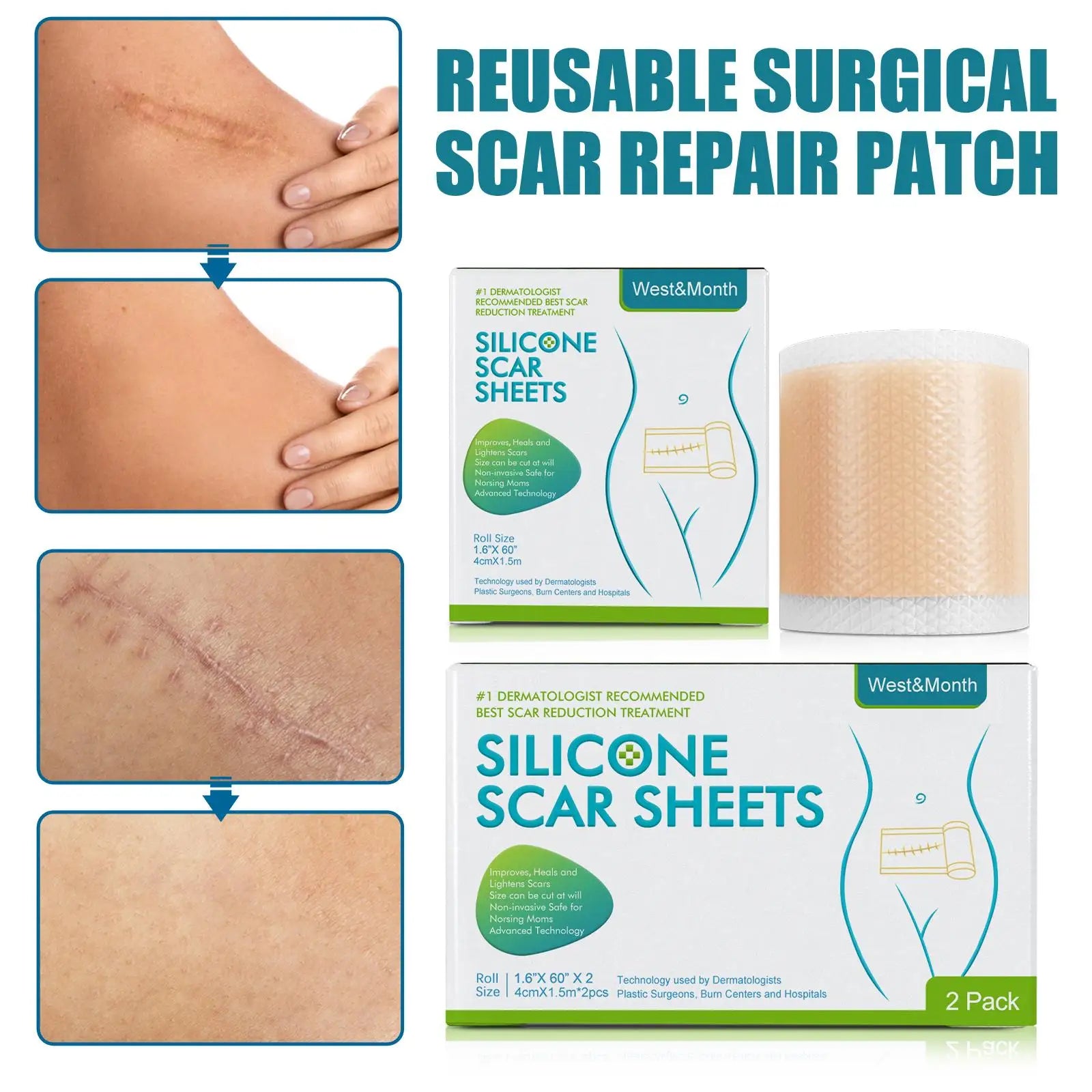 Silicone Scar Tape Sheets