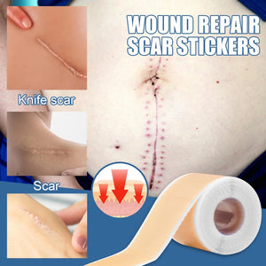 Silicone Scar Tape Sheets