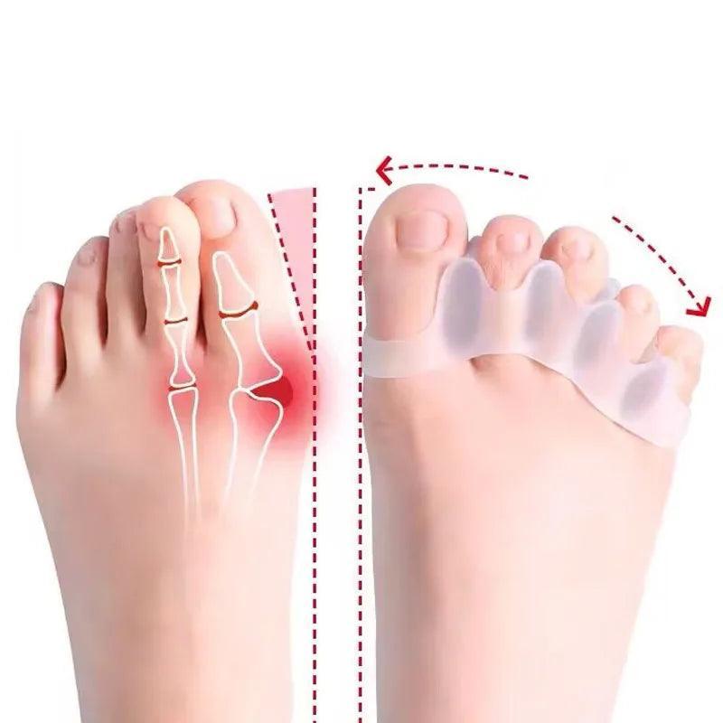 Silicone Toe Spacers